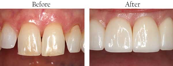 dental images 96753