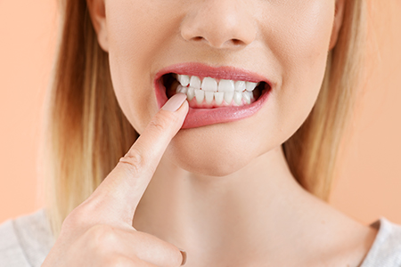 Woman with her finger on her teeth, smiling broadly, against a plain background.